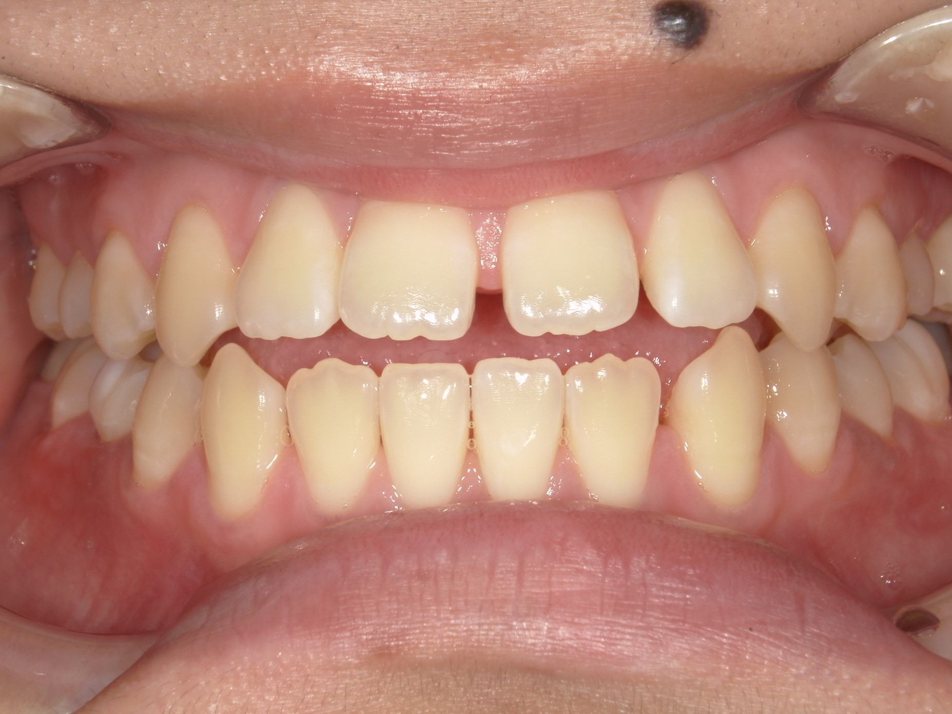 c4b1